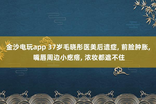 金沙电玩app 37岁毛晓彤医美后遗症， 前脸肿胀，<a href=